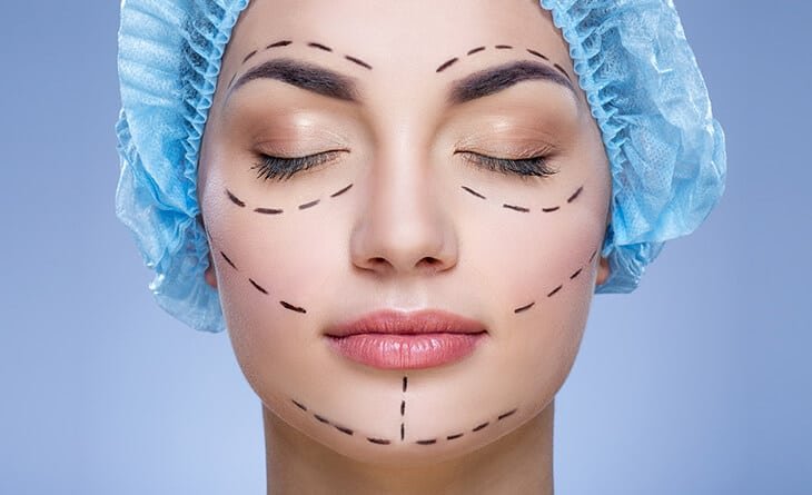 The Science Behind Facial Harmony in Plastic Surgery- Dr Rajat Gupta - Plastic Surgeon in Delhi - RG Aesthetics -03 Facelift Surgery