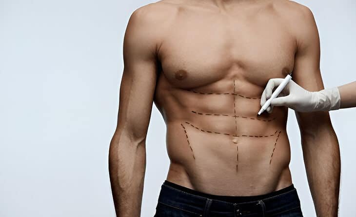 How Cosmetic Surgery Shapes Modern Masculinity - Cosmetic Surgeries for Men - RG Aesthetics -02 Cosmetic Surgeries for Men