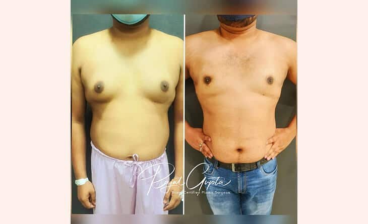 How Cosmetic Surgery Shapes Modern Masculinity - Cosmetic Surgeries for Men - RG Aesthetics -03 Cosmetic Surgeries for Men