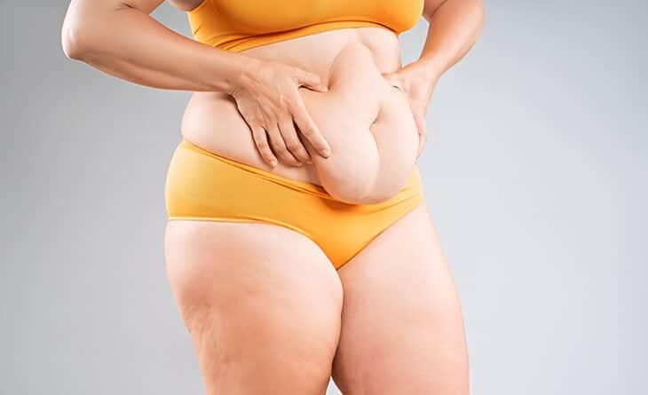How Painful Is a Tummy Tuck - Dr Rajat Gupta - Plastic Surgeon in Delhi -02 Tummy Tuck Surgery