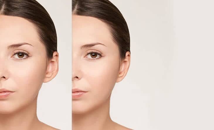 What Is Ear Pinning and What Does It Do - Dr rajat gupta - plastic surgeon in delhi -01 ear pinning procedure