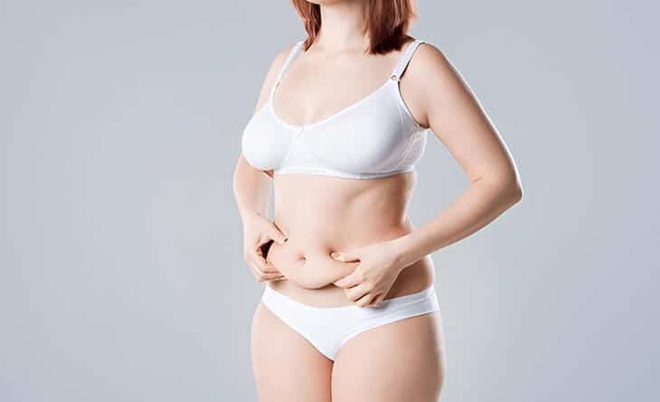 What is Diastasis Recti – How Can a Tummy Tuck Help - Dr Rajat Gupta - Plastic Surgeon in Delhi - RG Aesthetics -02 tummy tuck surgery