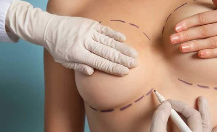 Benefits of Breast Reconstruction After Fighting Cancer - Dr Rajat Gupta - Plastic surgeon in Delhi - 03 Breast reconstruction surgery