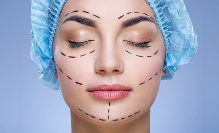 Combining a Facelift with Eyelid Surgery - Dr Rajat Gupta - Plastic Surgeon in Delhi -01 Facelift Surgery Procedure