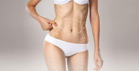 High-Definition Liposuction