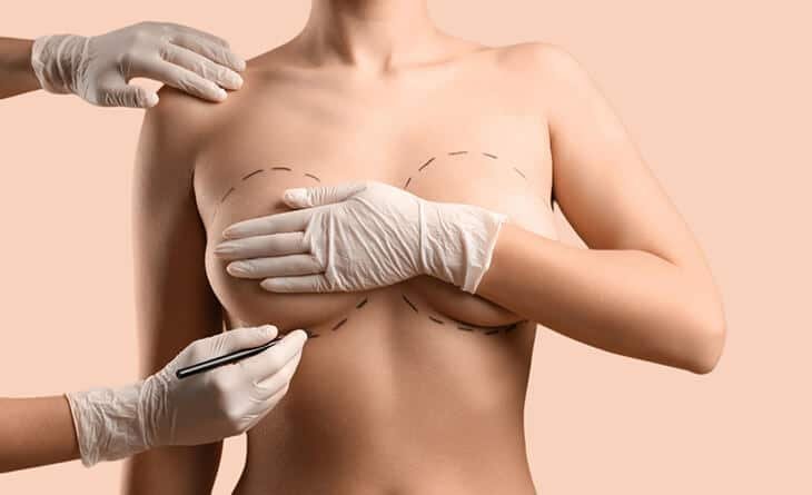What Kind of Breast Surgery Should You Get - Dr Rajat Gupta - Plastic Surgeon in Delhi - RG Aesthetics -02 breast surgery types