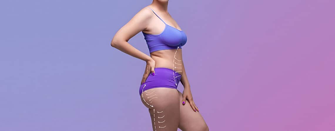 High-Definition Abdominoplasty in Delhi - SHARP Tummy Tuck- Dr Rajat Gupta -01 High-Definition Abdominoplasty in Delhi